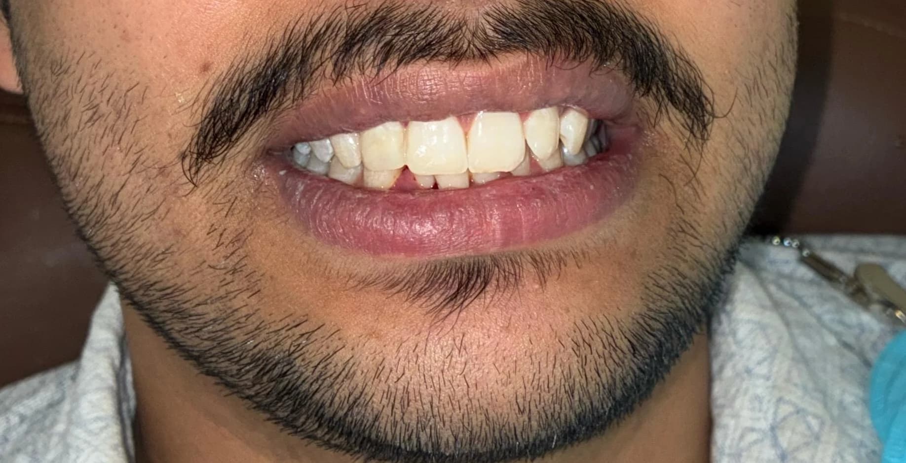 Patient story image 3.1